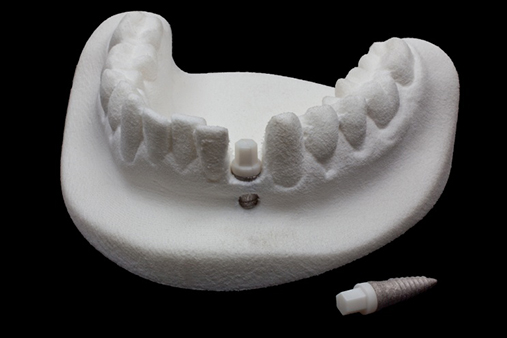 Powder Injection Molding